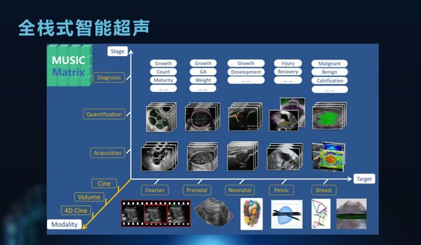 理邦全栈式智能医学超声