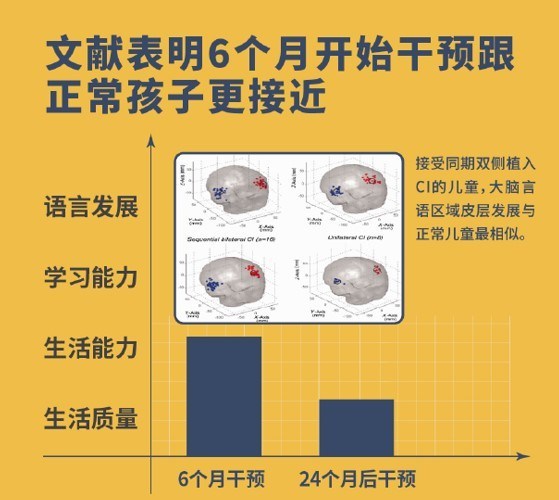 文献表明6个月开始干预与正常孩子更接近